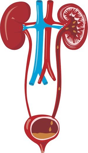 Ilustración de las vías urinarias